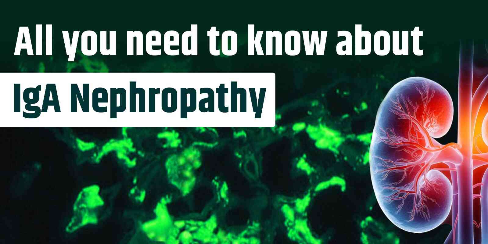 All you need to know about IgA Nephropathy